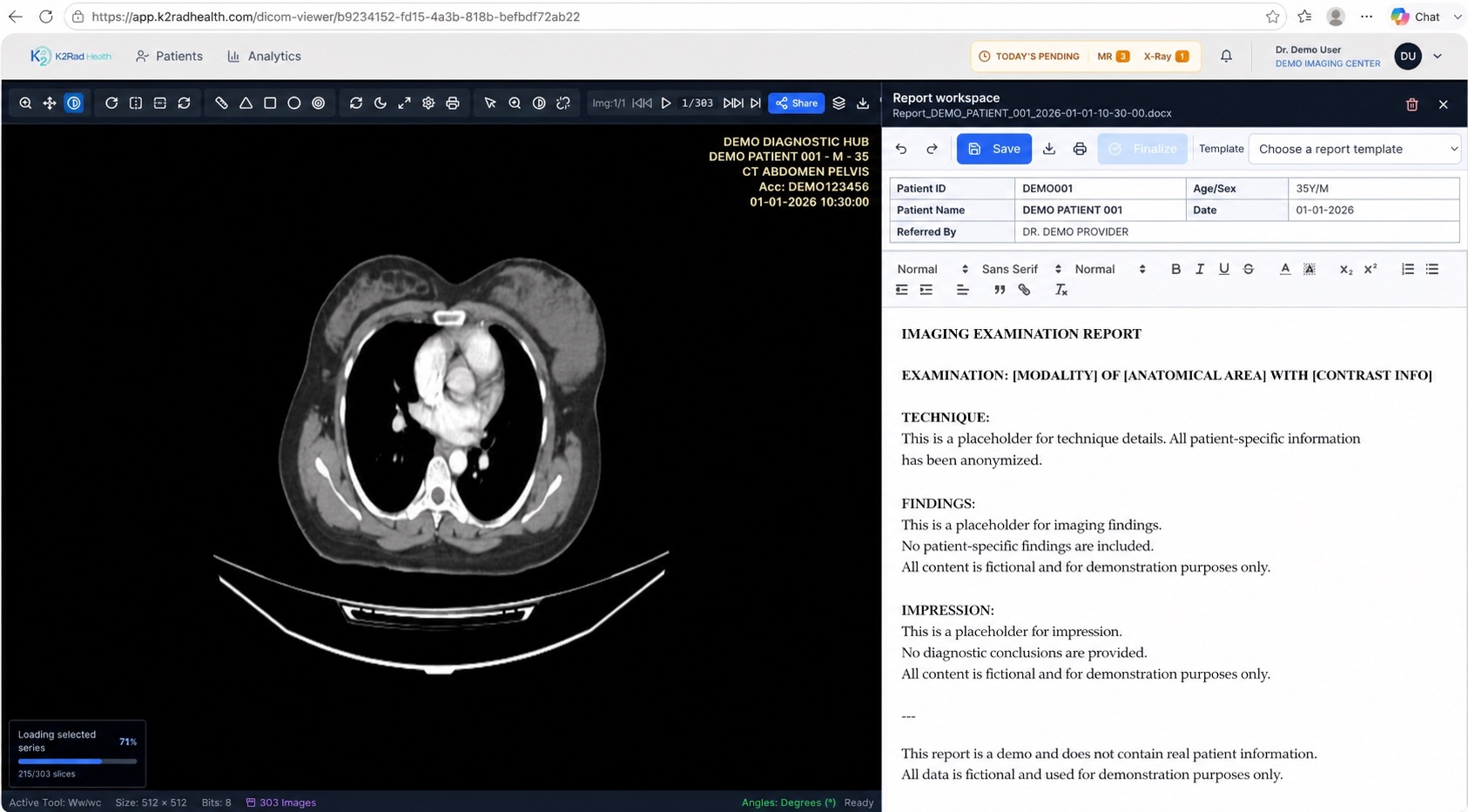 K2Rad web DICOM viewer with integrated side-by-side radiology report workspace